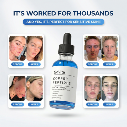 GVN GHK-Cu Peptide Serum